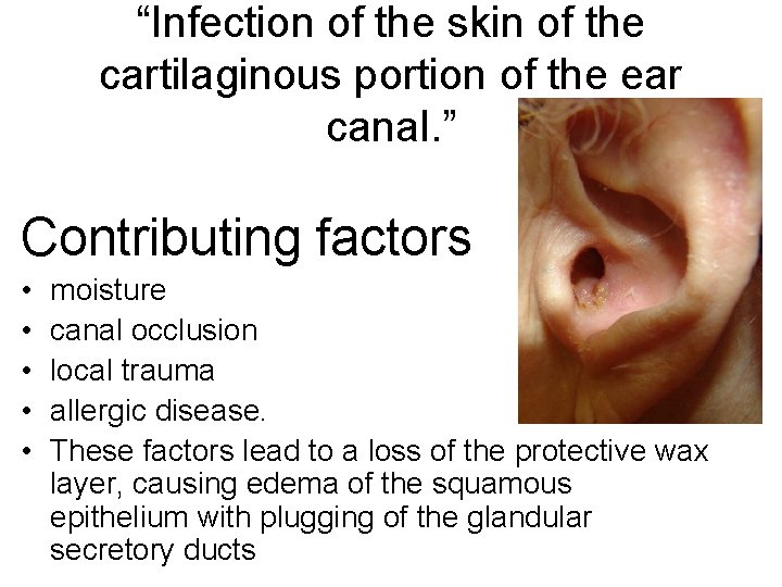 “Infection of the skin of the cartilaginous portion of the ear canal. ” Contributing