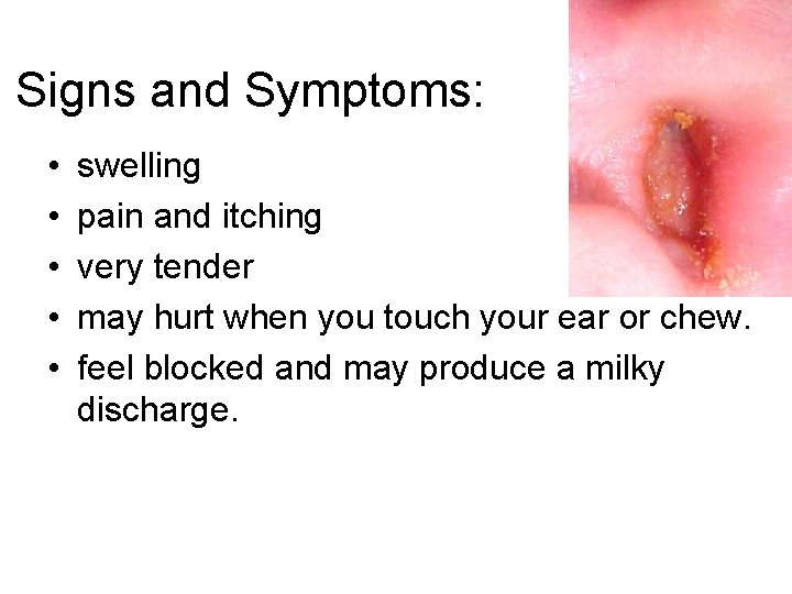 Signs and Symptoms: • • • swelling pain and itching very tender may hurt