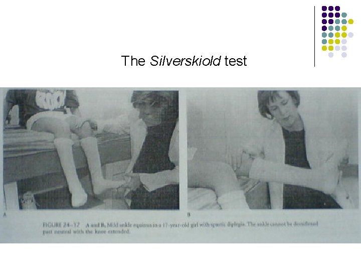 The Silverskiold test 