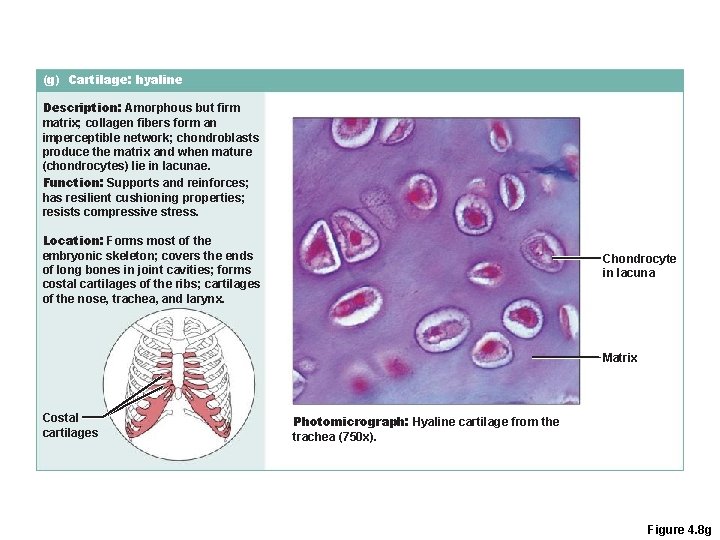 (g) Cartilage: hyaline Description: Amorphous but firm matrix; collagen fibers form an imperceptible network; (g) Cartilage: hyaline Description: Amorphous but firm matrix; collagen fibers form an imperceptible network;