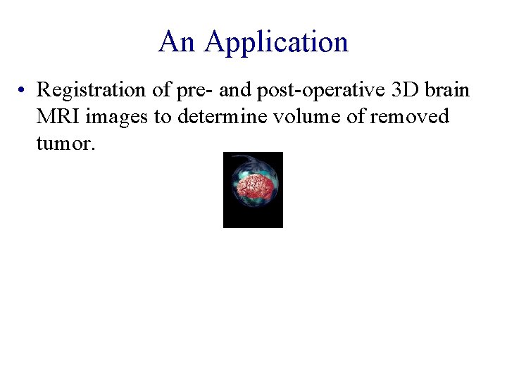 An Application • Registration of pre- and post-operative 3 D brain MRI images to An Application • Registration of pre- and post-operative 3 D brain MRI images to