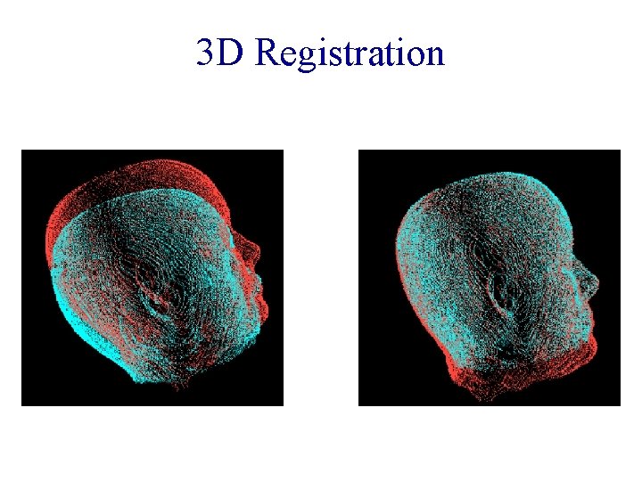 3 D Registration 3 D Registration