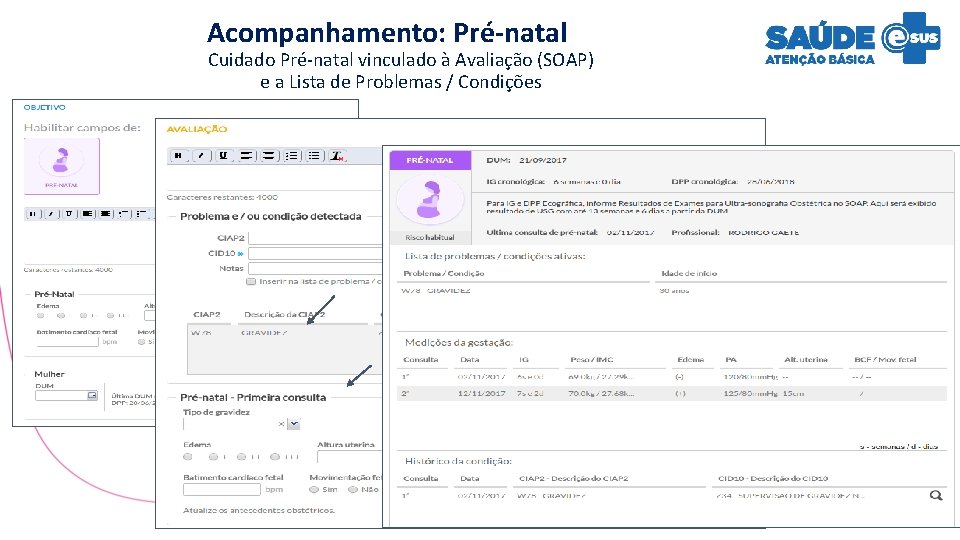 Acompanhamento: Pré-natal Cuidado Pré-natal vinculado à Avaliação (SOAP) e a Lista de Problemas /