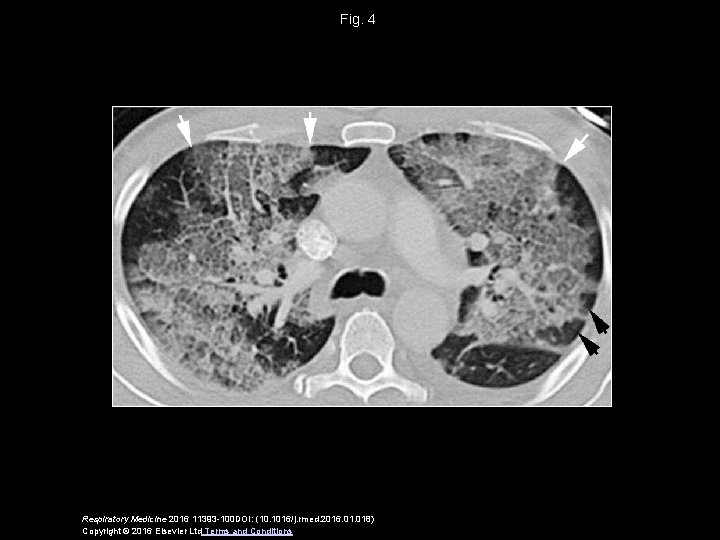 Fig. 4 Respiratory Medicine 2016 11393 -100 DOI: (10. 1016/j. rmed. 2016. 018) Copyright