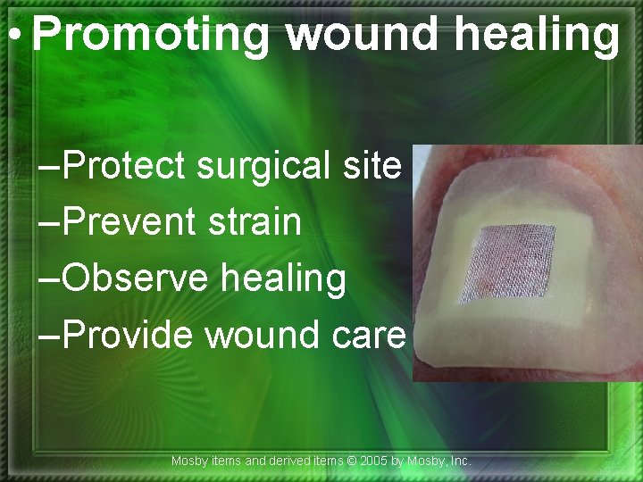  • Promoting wound healing –Protect surgical site –Prevent strain –Observe healing –Provide wound