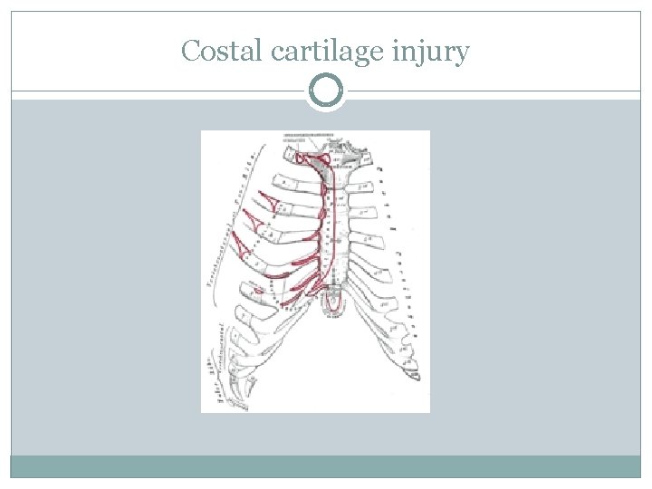 Costal cartilage injury 