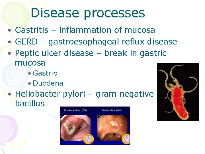 Disease processes • Gastritis – inflammation of mucosa • GERD – gastroesophageal reflux disease