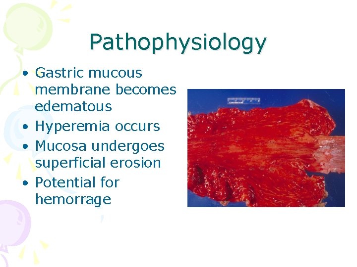 Pathophysiology • Gastric mucous membrane becomes edematous • Hyperemia occurs • Mucosa undergoes superficial