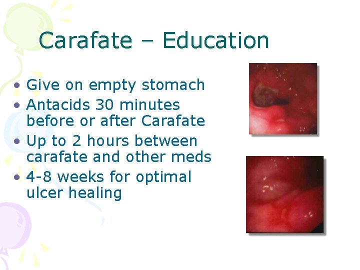 Carafate – Education • Give on empty stomach • Antacids 30 minutes before or