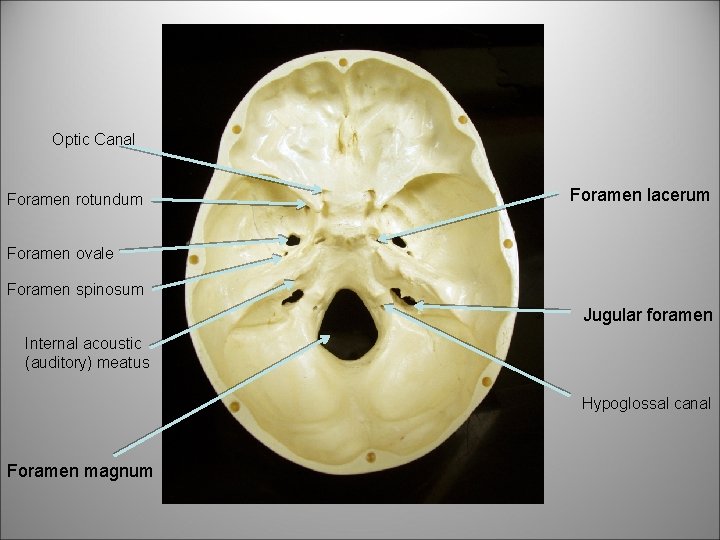 Optic Canal Foramen rotundum Foramen lacerum Foramen ovale Foramen spinosum Jugular foramen Internal acoustic