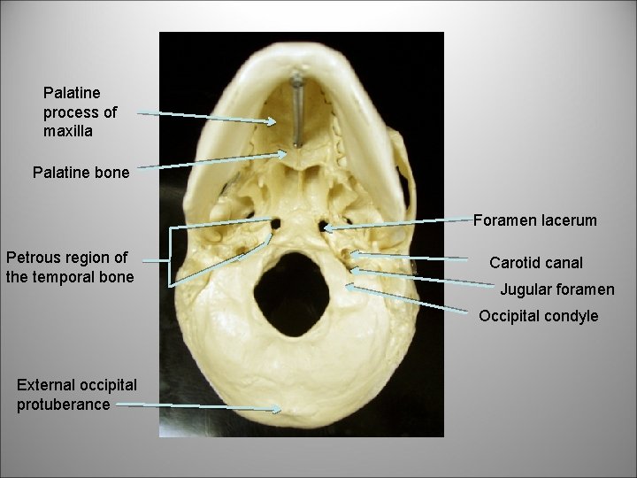 Palatine process of maxilla Palatine bone Foramen lacerum Petrous region of the temporal bone