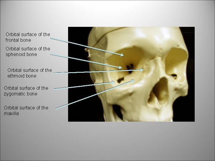 Orbital surface of the frontal bone Orbital surface of the sphenoid bone Orbital surface