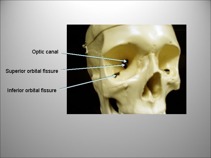 Optic canal Superior orbital fissure Inferior orbital fissure 