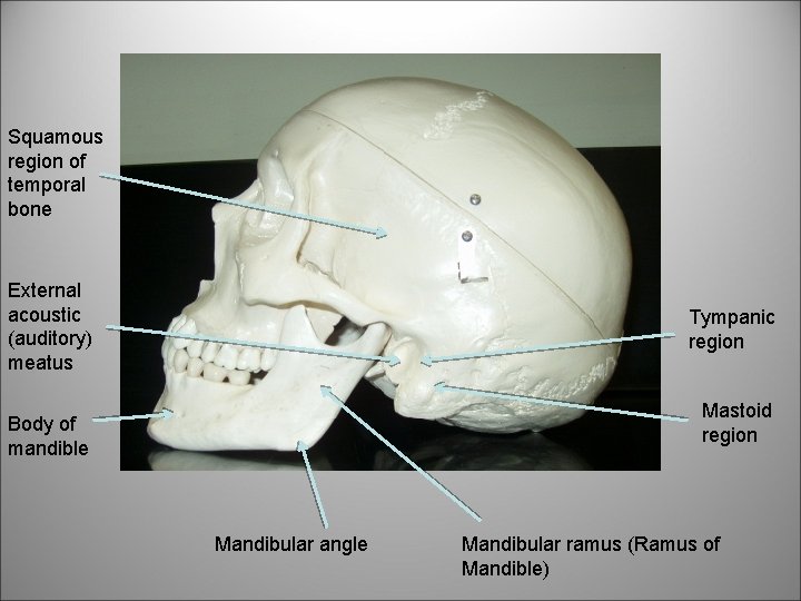 Squamous region of temporal bone External acoustic (auditory) meatus Tympanic region Mastoid region Body