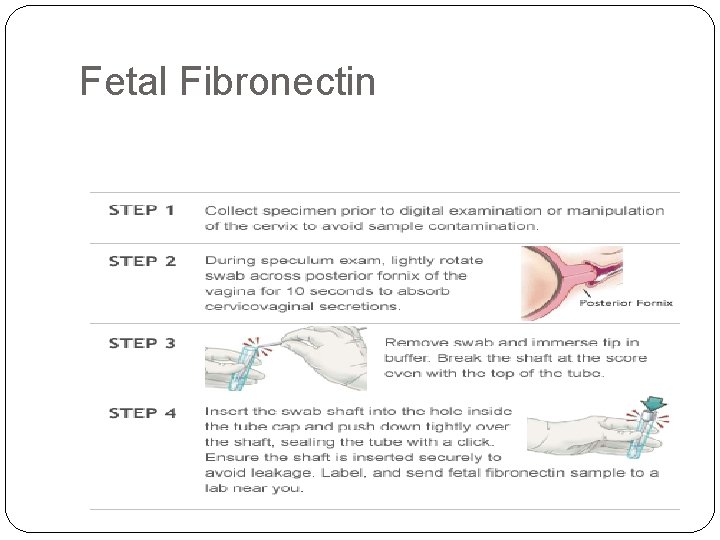 Fetal Fibronectin 
