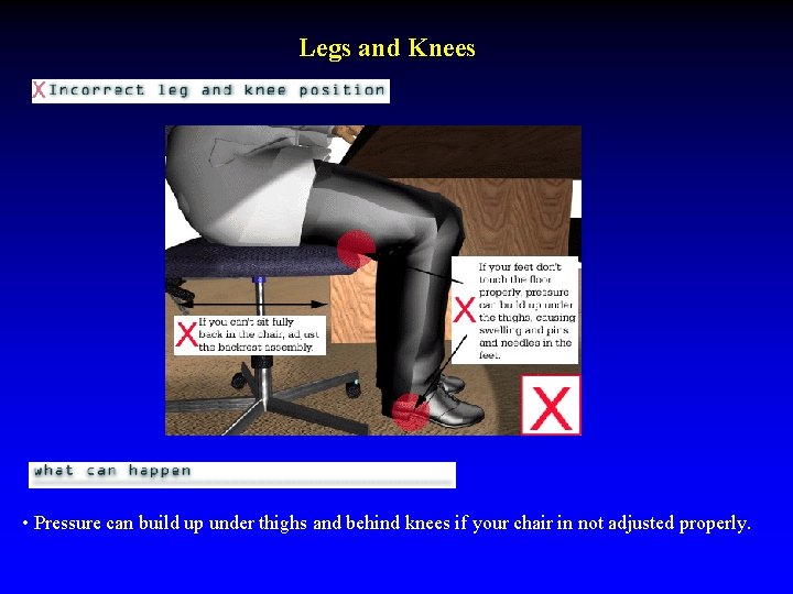 Legs and Knees • Pressure can build up under thighs and behind knees if