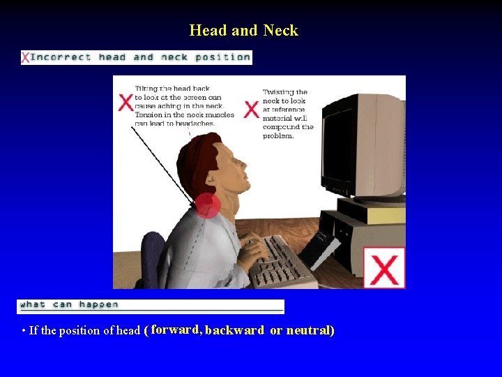 Head and Neck • If the position of head ( forward, backward or neutral)