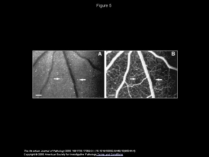 Figure 5 The American Journal of Pathology 2000 1561733 -1739 DOI: (10. 1016/S 0002