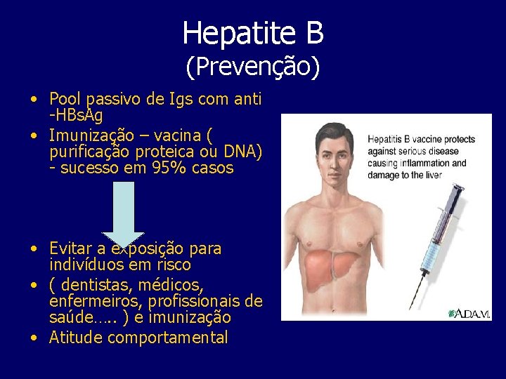 Hepatite B (Prevenção) • Pool passivo de Igs com anti -HBs. Ag • Imunização