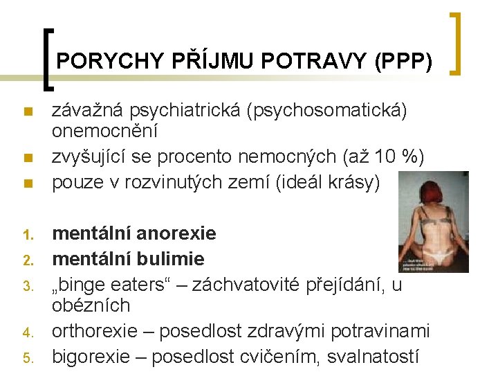 PORYCHY PŘÍJMU POTRAVY (PPP) n n n 1. 2. 3. 4. 5. závažná psychiatrická