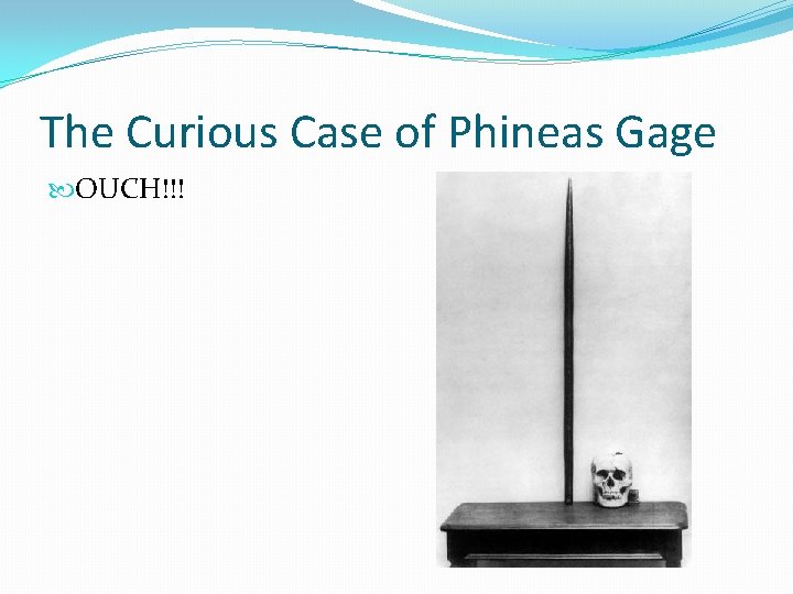 The Curious Case of Phineas Gage OUCH!!! 
