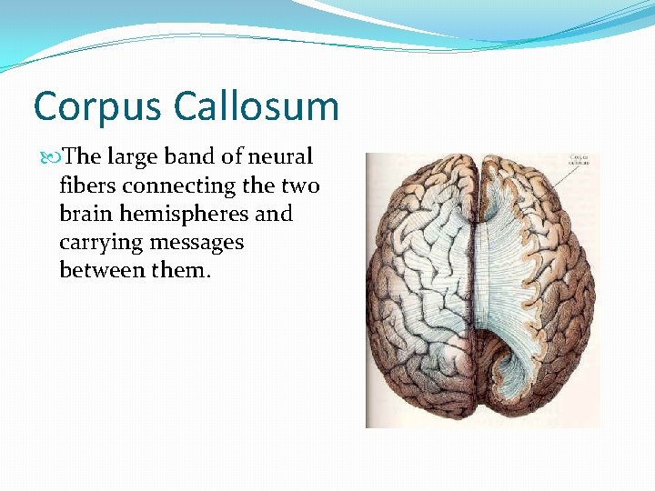 Corpus Callosum The large band of neural fibers connecting the two brain hemispheres and
