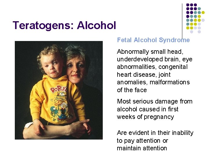 Teratogens: Alcohol Fetal Alcohol Syndrome Abnormally small head, underdeveloped brain, eye abnormalities, congenital heart Teratogens: Alcohol Fetal Alcohol Syndrome Abnormally small head, underdeveloped brain, eye abnormalities, congenital heart