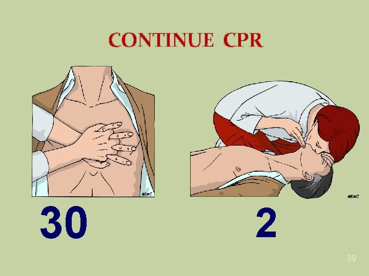 CONTINUE CPR 30 2 39 