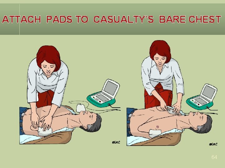 ATTACH PADS TO CASUALTY’S BARE CHEST 64 