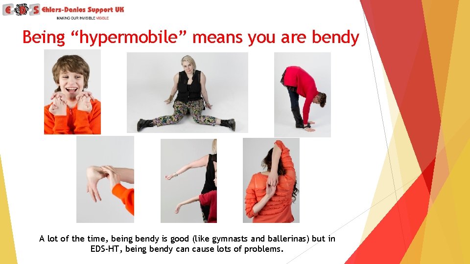 Being “hypermobile” means you are bendy A lot of the time, being bendy is
