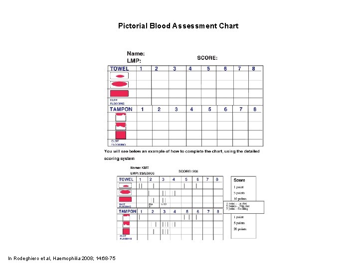 Pictorial Blood Assessment Chart In Rodeghiero et al, Haemophilia 2008; 14: 68 -75 