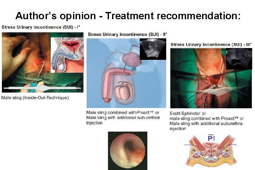 Author’s opinion - Treatment recommendation: 
