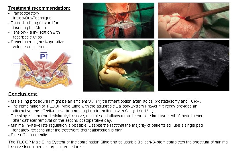 Treatment recommendation: - Transobtoratory Inside-Out-Technique - Thread to bring forward for inserting the Mesh