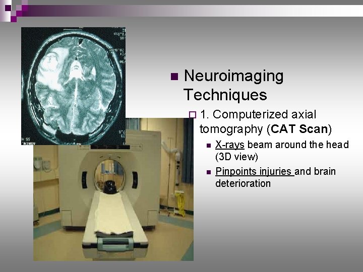 n Neuroimaging Techniques ¨ 1. Computerized axial tomography (CAT Scan) n n X-rays beam