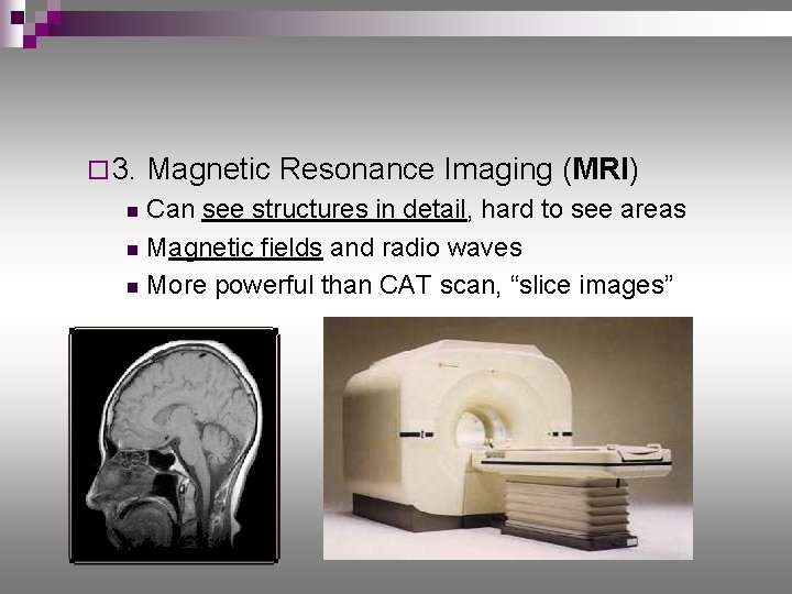 ¨ 3. Magnetic Resonance Imaging (MRI) Can see structures in detail, hard to see