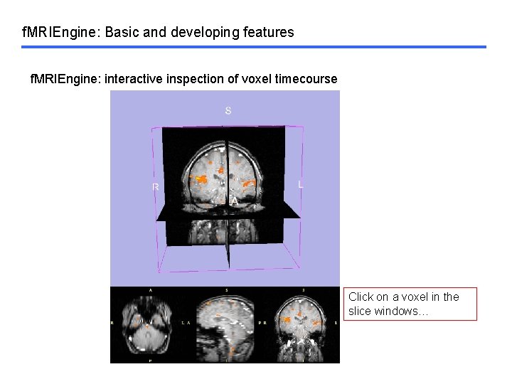 f. MRIEngine: Basic and developing features f. MRIEngine: interactive inspection of voxel timecourse Click