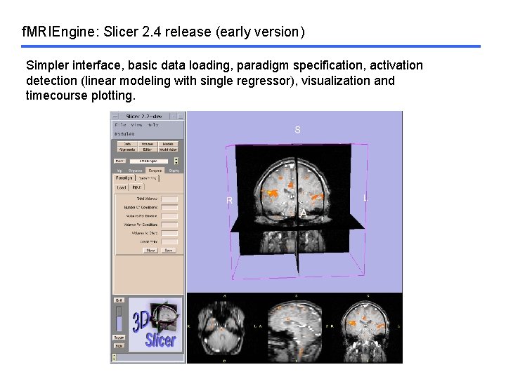 f. MRIEngine: Slicer 2. 4 release (early version) Simpler interface, basic data loading, paradigm