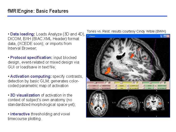f. MRIEngine: Basic Features • Data loading: Loads Analyze (3 D and 4 D),
