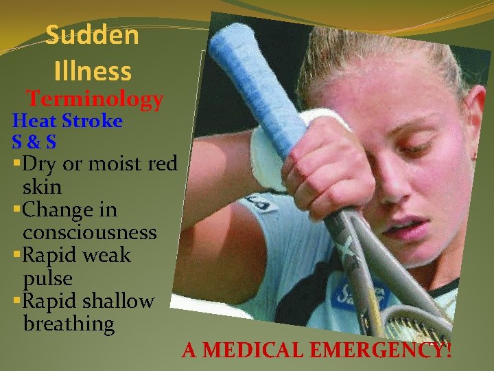 Sudden Illness Terminology Heat Stroke S&S §Dry or moist red skin §Change in consciousness