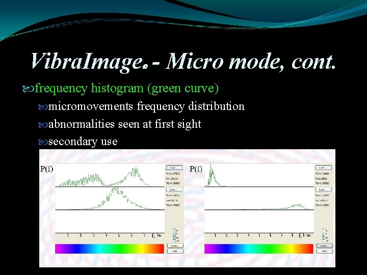 Vibra. Image - Micro mode, cont. frequency histogram (green curve) micromovements frequency distribution abnormalities