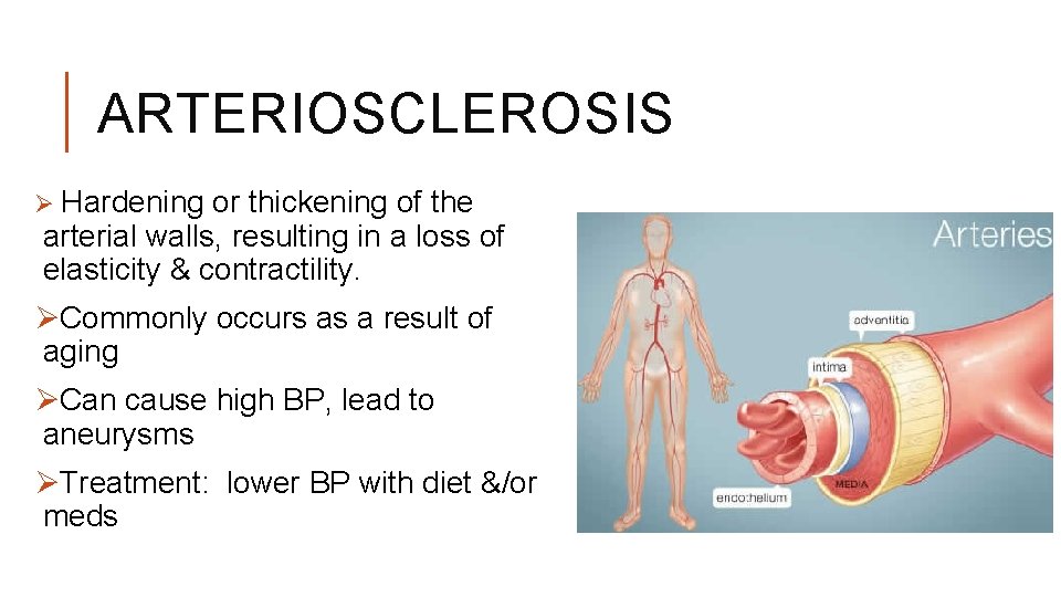 ARTERIOSCLEROSIS Ø Hardening or thickening of the arterial walls, resulting in a loss of