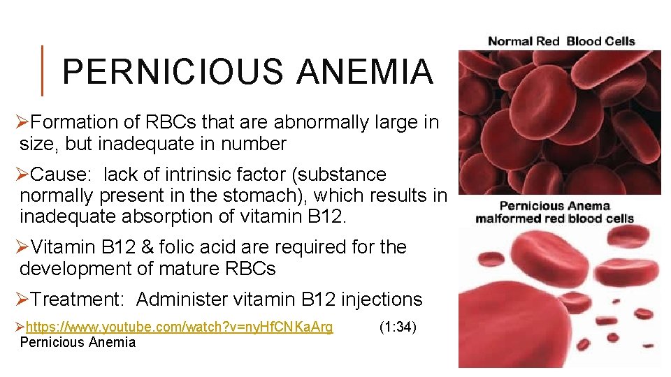 PERNICIOUS ANEMIA ØFormation of RBCs that are abnormally large in size, but inadequate in