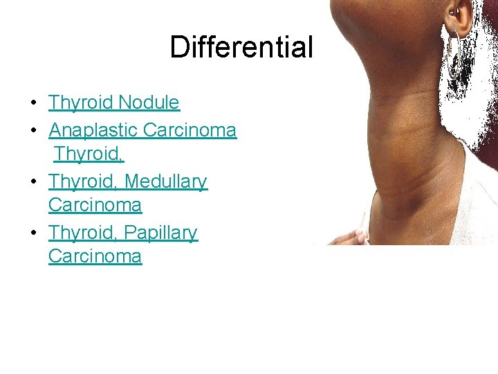 Differentials • Thyroid Nodule • Anaplastic Carcinoma Thyroid, • Thyroid, Medullary Carcinoma • Thyroid,