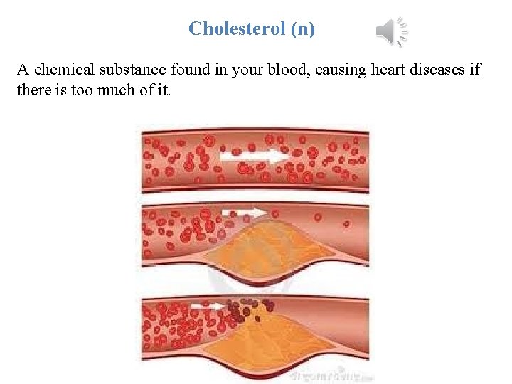 Cholesterol (n) A chemical substance found in your blood, causing heart diseases if there