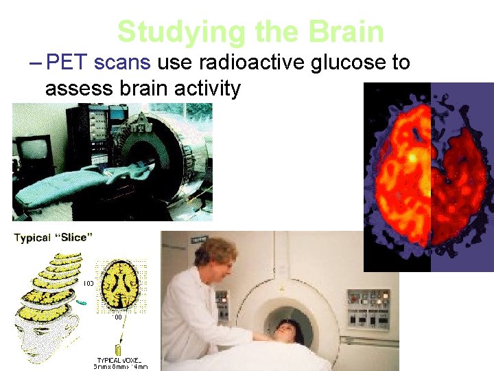 Studying the Brain – PET scans use radioactive glucose to assess brain activity 