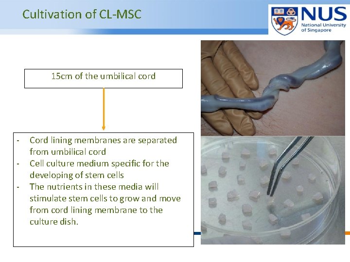 Cultivation of CL-MSC 15 cm of the umbilical cord - Cord lining membranes are