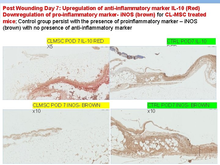 Post Wounding Day 7: Upregulation of anti-inflammatory marker IL-10 (Red) Downregulation of pro-inflammatory marker-