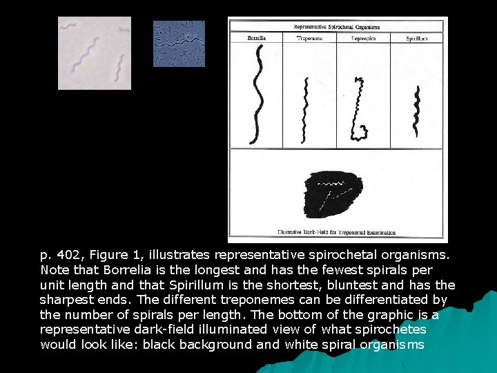 p. 402, Figure 1, illustrates representative spirochetal organisms. Note that Borrelia is the longest