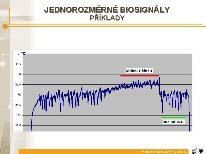 JEDNOROZMĚRNÉ BIOSIGNÁLY PŘÍKLADY © Institut biostatistiky a analýz 