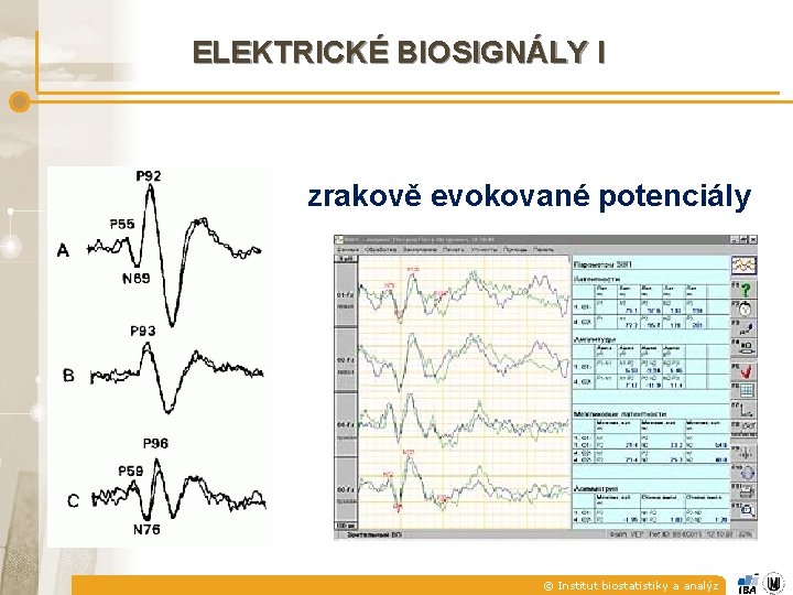 ELEKTRICKÉ BIOSIGNÁLY I zrakově evokované potenciály © Institut biostatistiky a analýz 